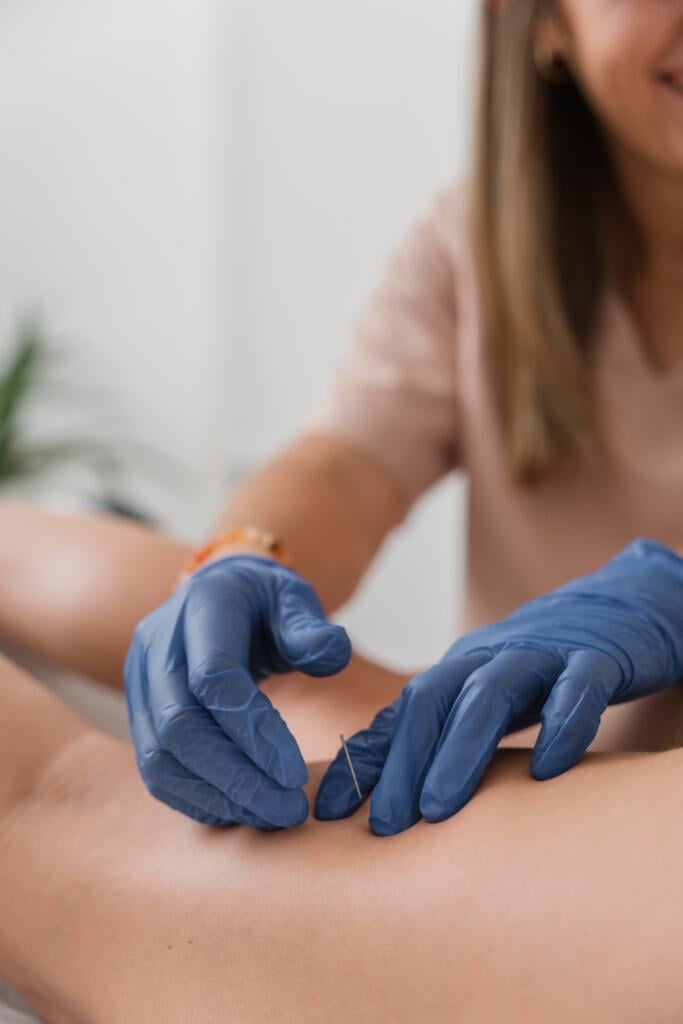 Physiotherapist,Applying,Dry,Needling,Technique,To,Patient's,Leg,For,Pain - Gardner Physical Therapy an example of dry needling at Gardner Physical Therapy treatment center